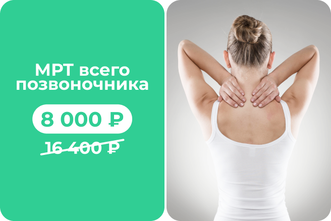 МРТ-чекап всего позвоночника за 8 000 рублей